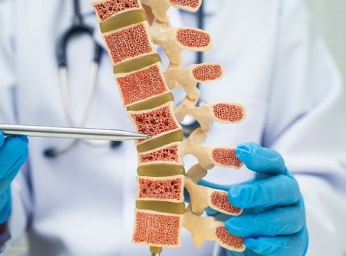 osteoporosis